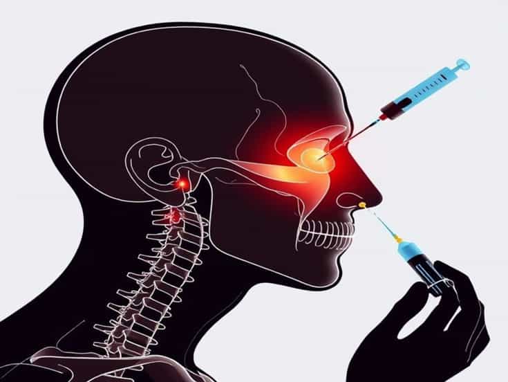 Nerve Damage From Facet Joint Injections
