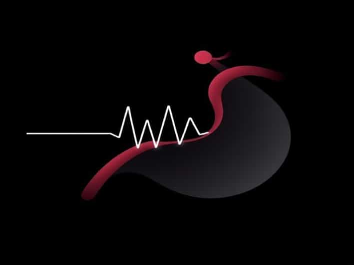 Reduced Diastolic Flow In Umbilical Artery
