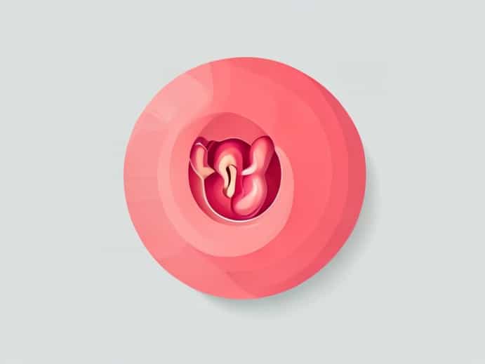 Fistula Recur After Surgery