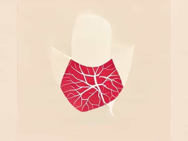 Lymph Fluid Buildup In Neck