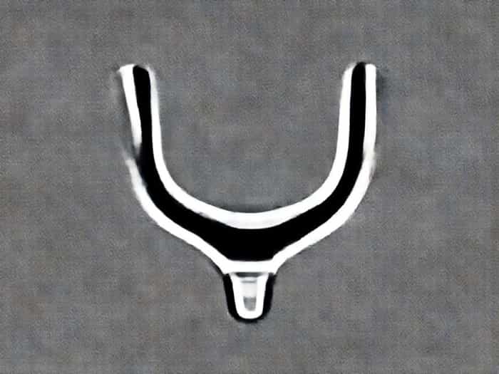 Urinary Bladder Wall Thickening