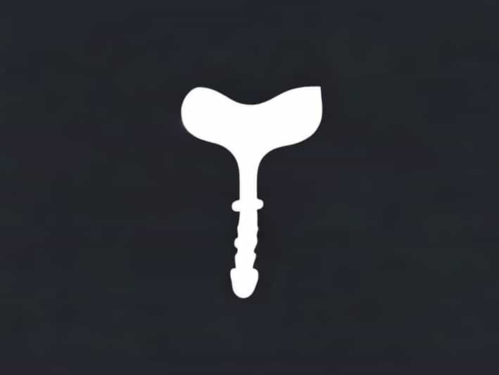 Course Of Ureter In Female Pelvis Ppt