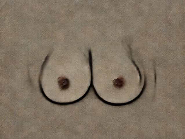 Cracked Scabbed Nipples Breastfeeding