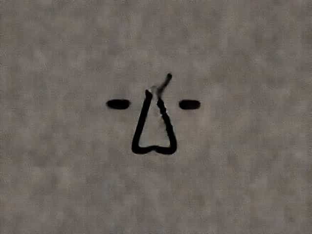 Do Hemorrhoids Protrude From The Anus