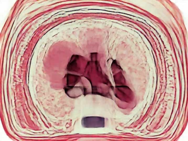 Histology Of Transitional Epithelium