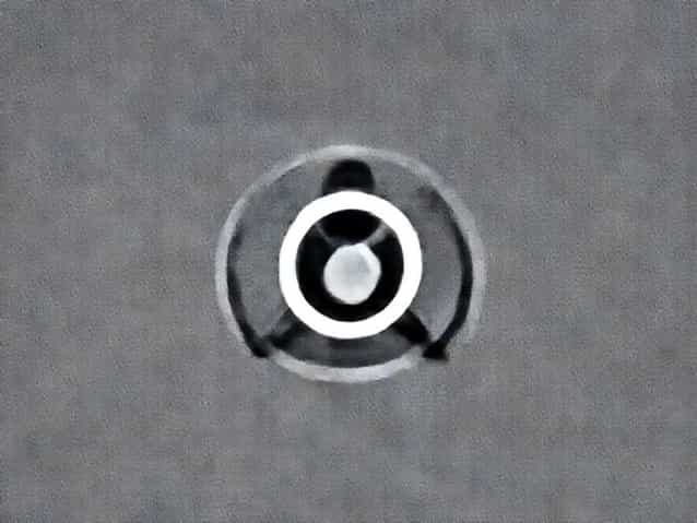 Is Stillbirth The Same As Miscarriage