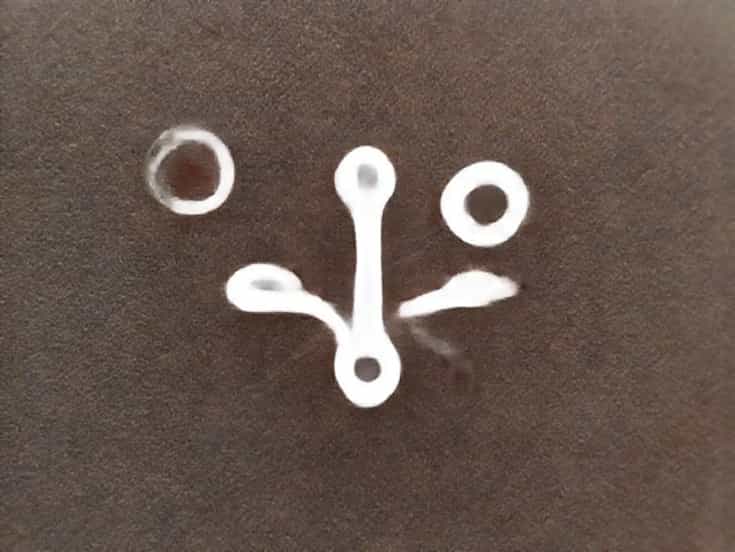 Pityriasis Versicolor Causative Agent