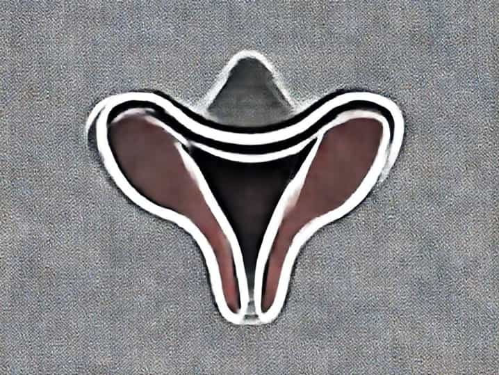 Urogenital Sinus Embryological Origin