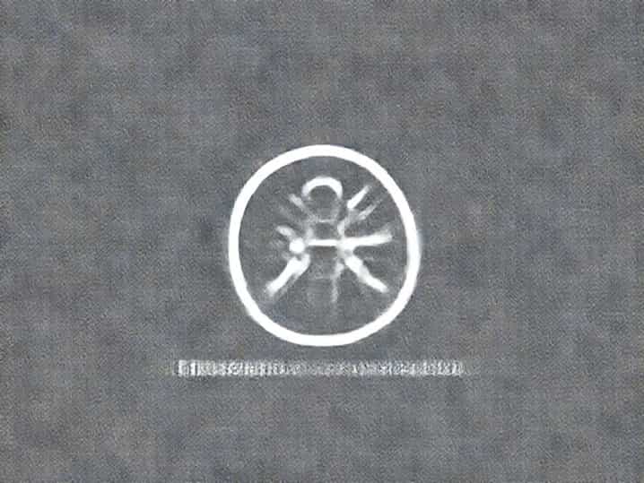 What Is Hypersensitivity Pneumonitis